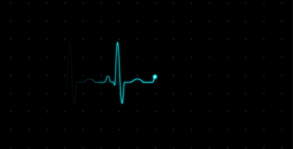 EKG (Heartbeat Monitor - Electrocardiogram)