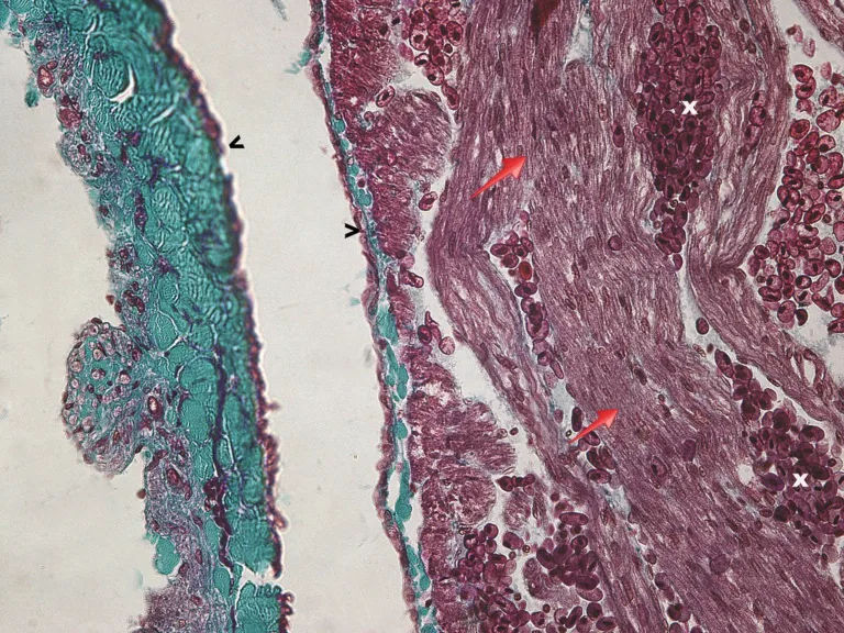 P3a_002_coeur sinus veineux oreillette_heart sinus venosus atrium_Scyliorhinus canicula